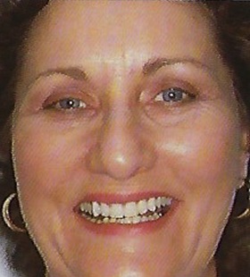 Woman with gorgeous smile after orthodontics