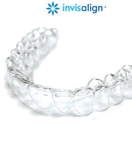 Invisalign special coupon