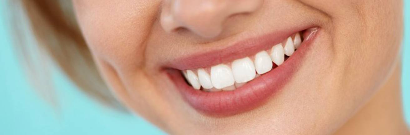 Woman smiling with white teeth