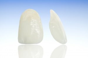 porcelain veneers from dentist in Mount Vernon