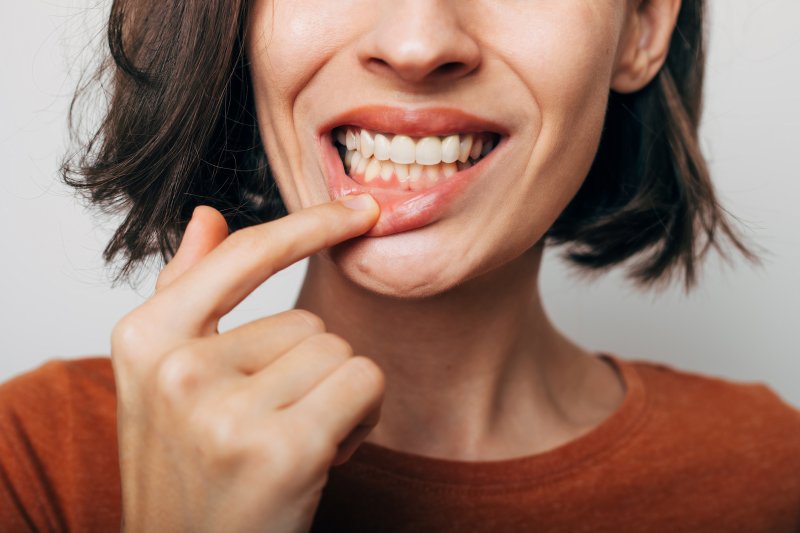 a woman showing signs of gum disease